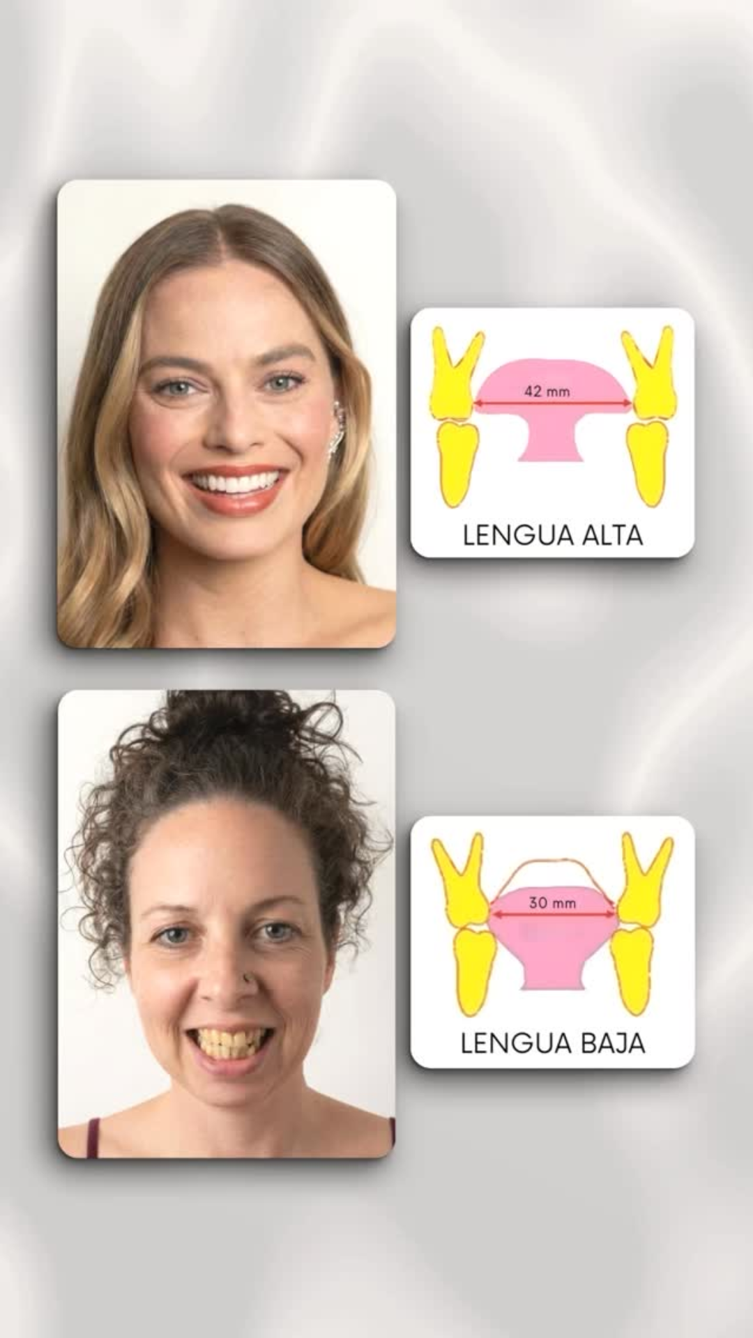 Conexión paladar y altura de la lengua